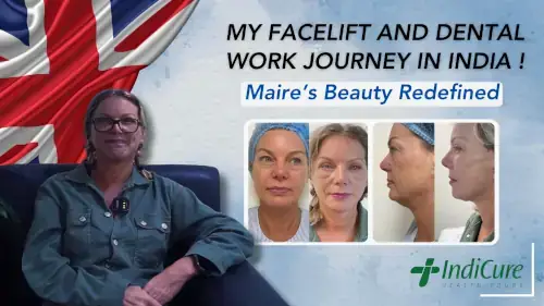 A UK patient shares her transformative facelift and dental work journey in India A UK patient shares her transformative facelift and dental work journey in India